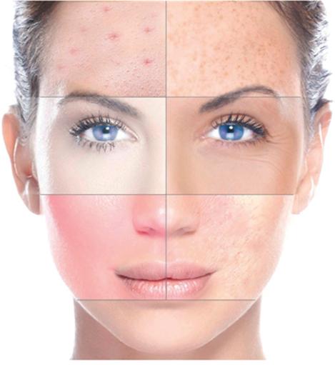 SKIN TYPE QUIZ, WHAT TYPE OF SKIN DO YOU HAVE AND WHAT DO YOU NEED? different skintype, my skin type, skincare, what type of skin do I have, elizkofbeauty