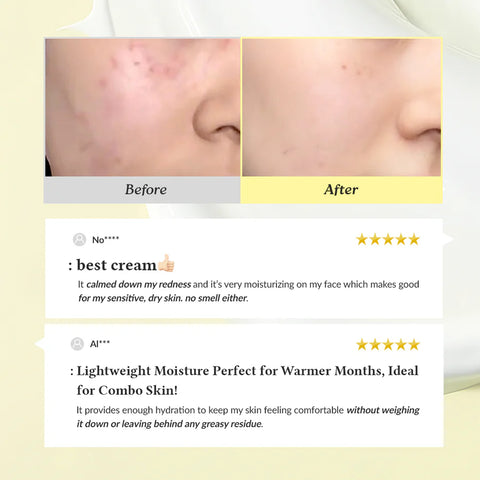 Dr.Althea 345 Relief Cream | Daily Face Moisturizer | Blemish Relief Care | Soothing Recovery & Moisture with Niacinamide, Panthenol | Korean Vegan Skin Care for All Skin Types