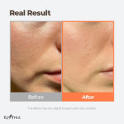 Green Tea Fresh Toner 200ml, 6.76 fl.oz | Korean Skincare | Toner for Oily Skin | Sebum Control | Hydrating and Refreshing