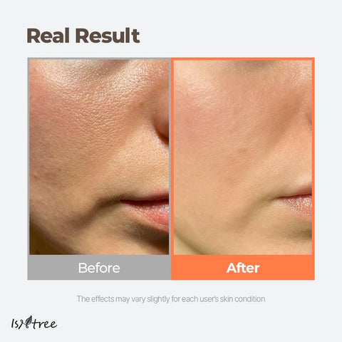 Green Tea Fresh Toner 200ml, 6.76 fl.oz | Korean Skincare | Toner for Oily Skin | Sebum Control | Hydrating and Refreshing