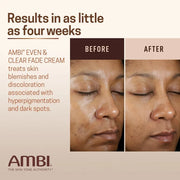 AMBI EVEN & CLEAR FADE CREAM - STUBBORN DARK SPOTS - ALL SKIN TYPES - 1OZ 30ML