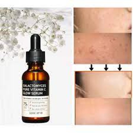 Galactomyces Pure Vitamin C Glow Serum-Pure Vitamin C 30,000 PPM / 10 Vitamins 75% Galactomyces Double Brightening Improve Your Skin Texture Non-Sticky Richness - elizkofbeauty