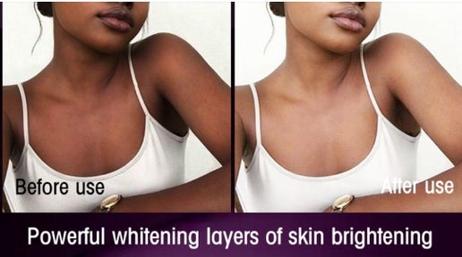 ROSE EXTREME.  Active skin Lightening Lotion for Face &amp; Body. - elizkofbeauty