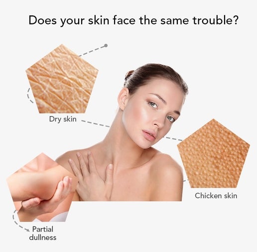 Fresh Body Lotion ( natural skin Lightening Lotion)Niacinamide creams with SPF++50 - elizkofbeauty