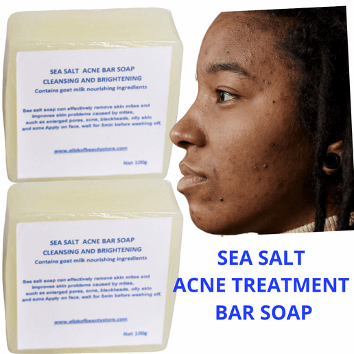 SEA SALT ACNE TREATMENT BAR SOAP.